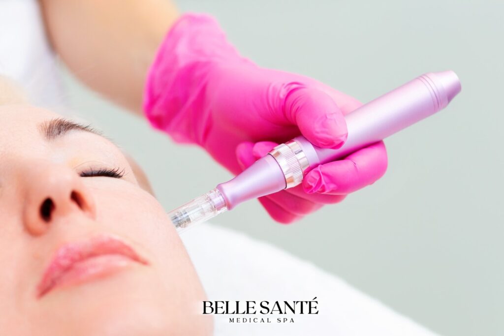 Woman Receiving Microneedling in St Clair Shores at Belle Santé Medical Spa