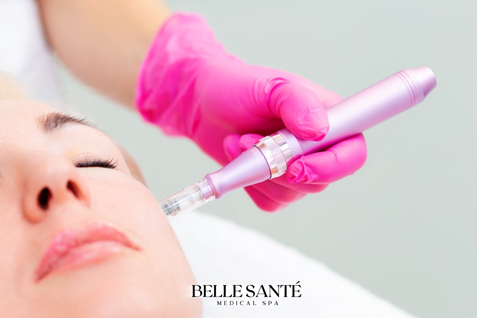 What Is Microneedling And What Are The Benefits Belle Sante Medical Spa