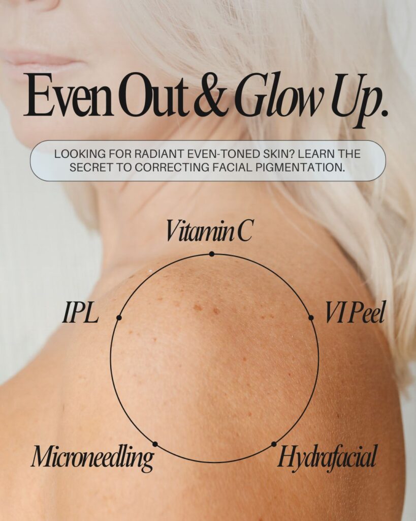 Close-up of the shoulder of an older woman with the words "Even Out & Glow Up" showing a circle concept between Vitamin C, VI Peel, Hydrafacial, Microneedling, and IPL.